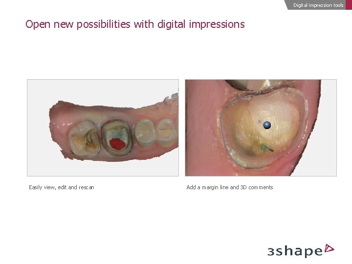 Digital impression tools Open new possibilities with digital impressions Easily view, edit and rescan