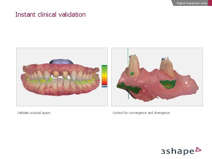 Digital impression tools Instant clinical validation Validate occlusal space Control for convergence and divergence