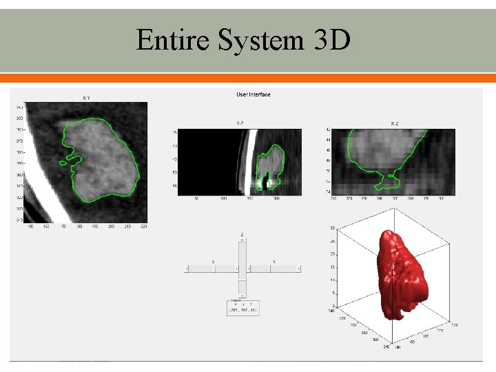 Entire System 3 D 