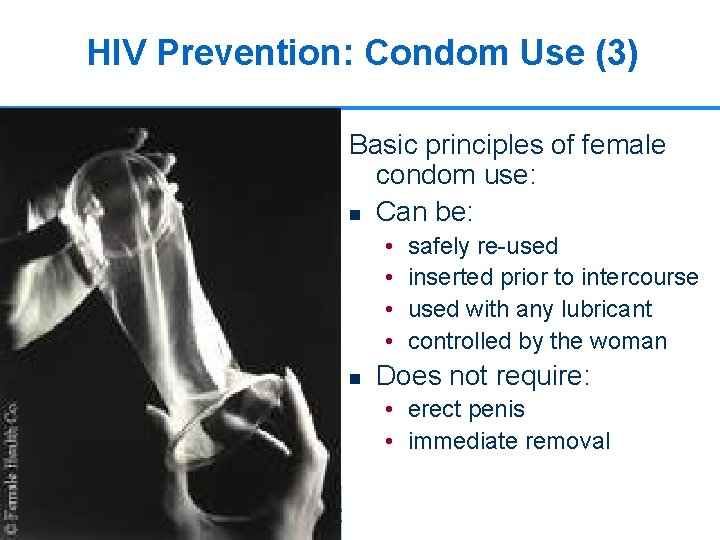 HIV Prevention: Condom Use (3) Basic principles of female condom use: n Can be: HIV Prevention: Condom Use (3) Basic principles of female condom use: n Can be: