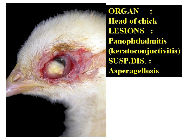 ORGAN : Head of chick LESIONS : Panophthalmitis (keratoconjuctivitis) SUSP. DIS. : Asperagellosis 