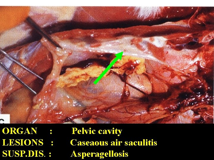 ORGAN : LESIONS : SUSP. DIS. : Pelvic cavity Caseaous air saculitis Asperagellosis 