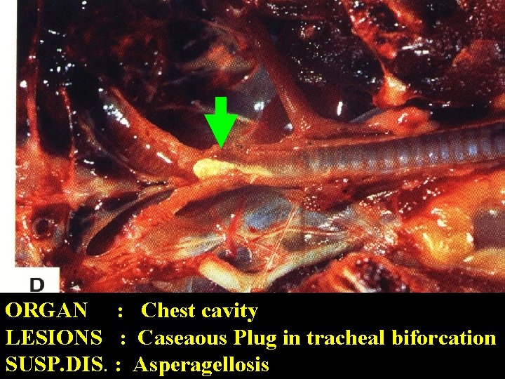 ORGAN : Chest cavity LESIONS : Caseaous Plug in tracheal biforcation SUSP. DIS. :