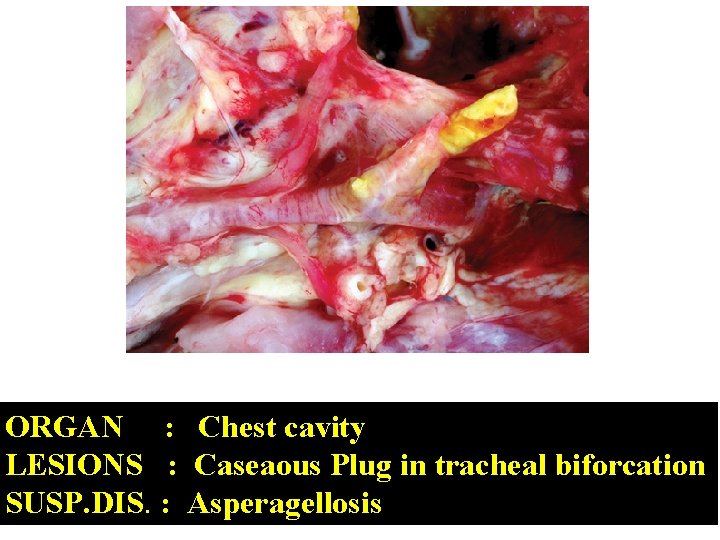 ORGAN : Chest cavity LESIONS : Caseaous Plug in tracheal biforcation SUSP. DIS. :