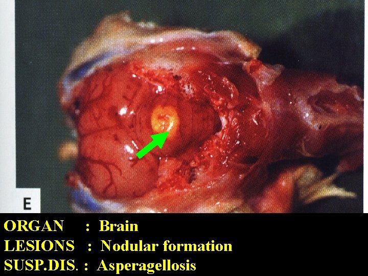 ORGAN : Brain LESIONS : Nodular formation SUSP. DIS. : Asperagellosis 