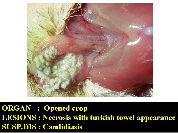 ORGAN : Opened crop LESIONS : Necrosis with turkish towel appearance SUSP. DIS :