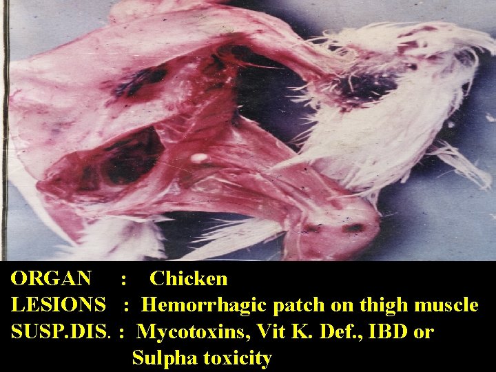 ORGAN : Chicken LESIONS : Hemorrhagic patch on thigh muscle SUSP. DIS. : Mycotoxins,