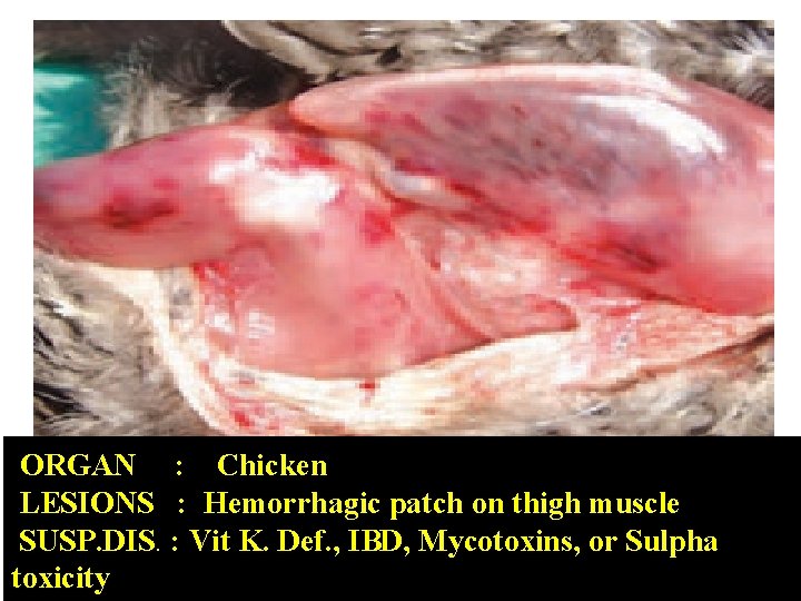 ORGAN : Chicken LESIONS : Hemorrhagic patch on thigh muscle SUSP. DIS. : Vit