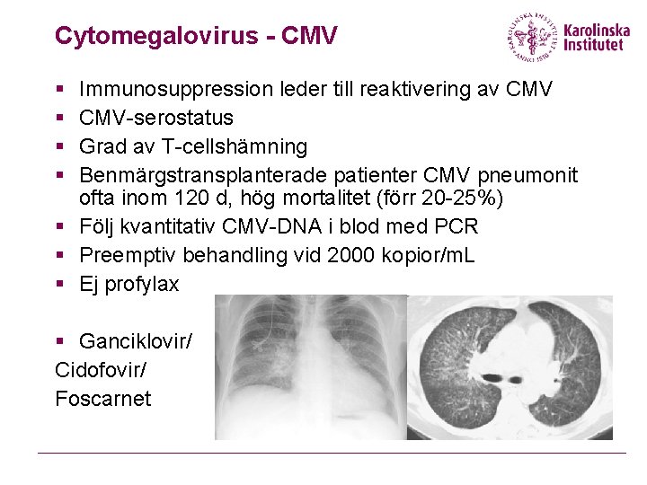 Cytomegalovirus - CMV § § Immunosuppression leder till reaktivering av CMV-serostatus Grad av T-cellshämning
