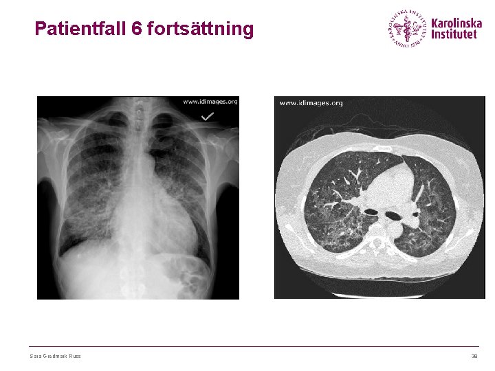 Patientfall 6 fortsättning Sara Gredmark Russ 38 