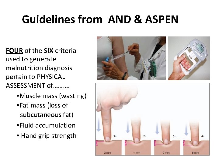 Guidelines from AND & ASPEN FOUR of the SIX criteria used to generate malnutrition
