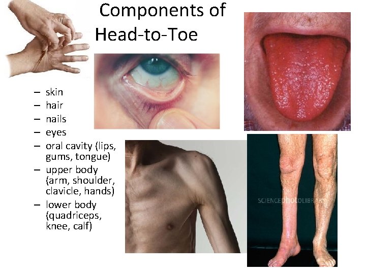 Components of Head-to-Toe skin hair nails eyes oral cavity (lips, gums, tongue) – upper