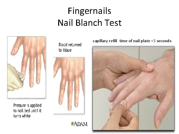 Fingernails Nail Blanch Test capillary refill time of nail plate <3 seconds 