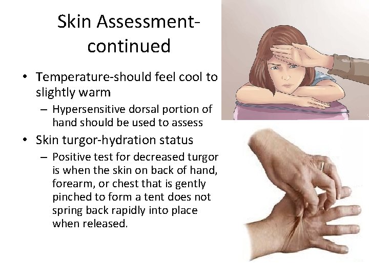 Skin Assessmentcontinued • Temperature-should feel cool to slightly warm – Hypersensitive dorsal portion of