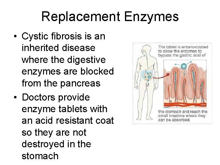 Replacement Enzymes • Cystic fibrosis is an inherited disease where the digestive enzymes are