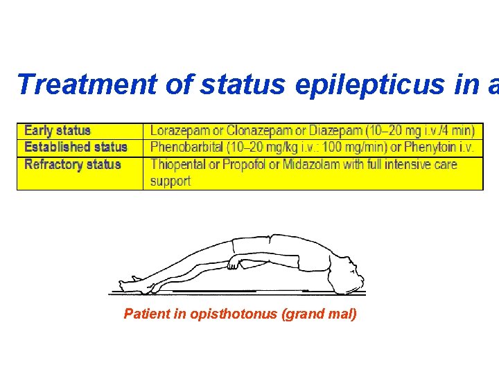 Treatment of status epilepticus in a Patient in opisthotonus (grand mal) 