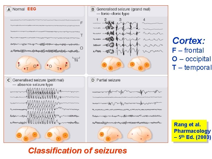 EEG Cortex: F – frontal O – occipital T – temporal Rang et al.