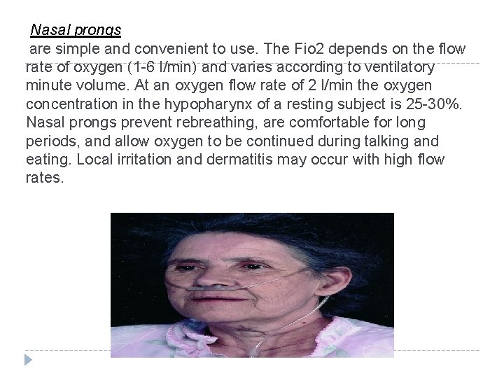 Nasal prongs are simple and convenient to use. The Fio 2 depends on the Nasal prongs are simple and convenient to use. The Fio 2 depends on the