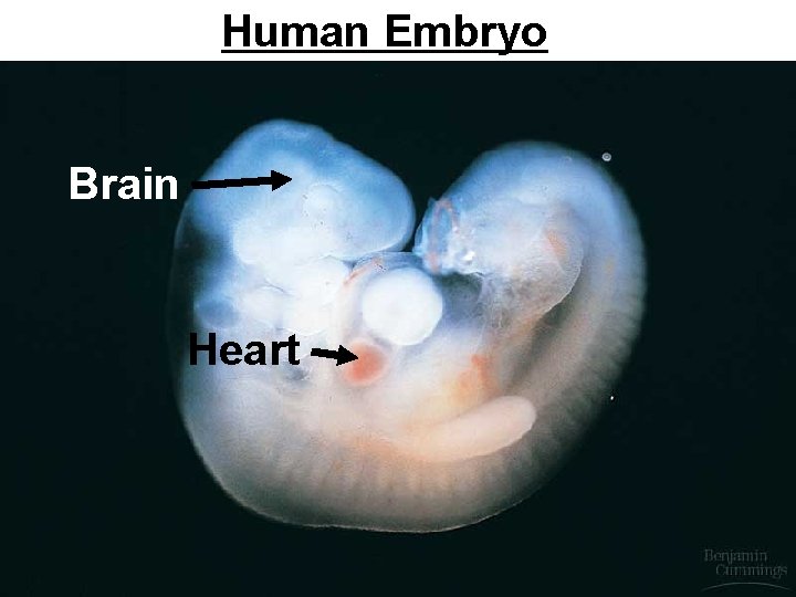 Human Embryo Brain Heart 