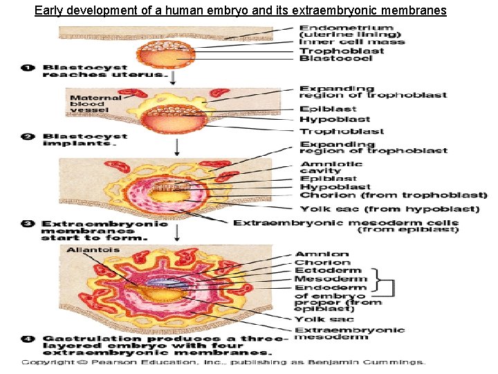 Early development of a human embryo and its extraembryonic membranes 