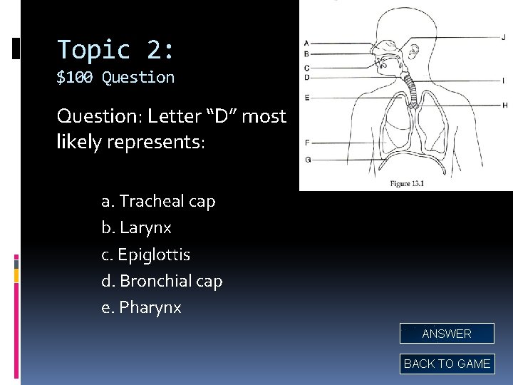 Topic 2: $100 Question: Letter “D” most likely represents: a. Tracheal cap b. Larynx