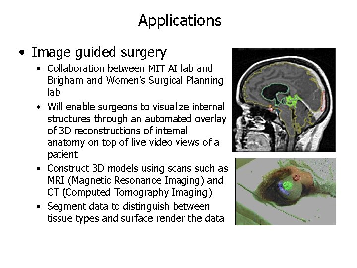 Applications • Image guided surgery • Collaboration between MIT AI lab and Brigham and