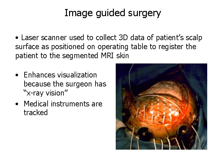 Image guided surgery • Laser scanner used to collect 3 D data of patient’s