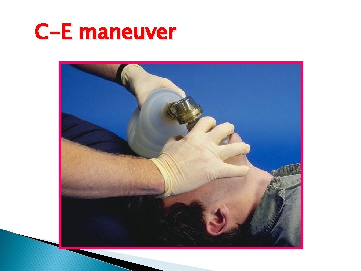 C-E maneuver C-E maneuver