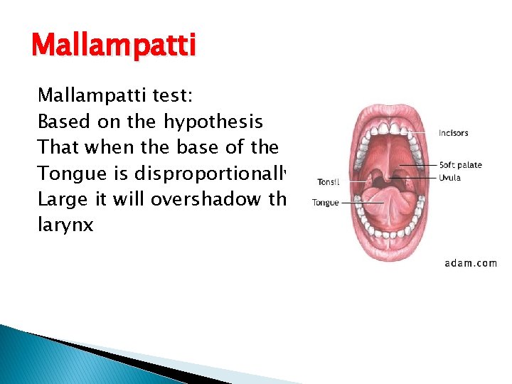 Mallampatti test: Based on the hypothesis That when the base of the Tongue is Mallampatti test: Based on the hypothesis That when the base of the Tongue is