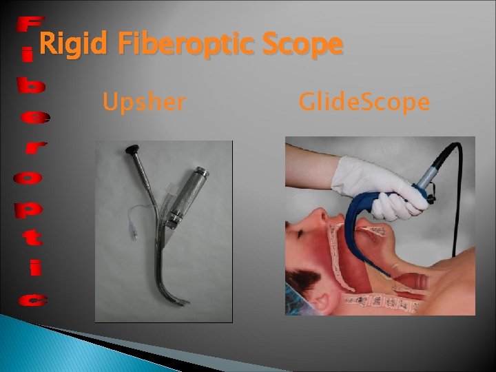 Rigid Fiberoptic Scope Upsher Glide. Scope Rigid Fiberoptic Scope Upsher Glide. Scope