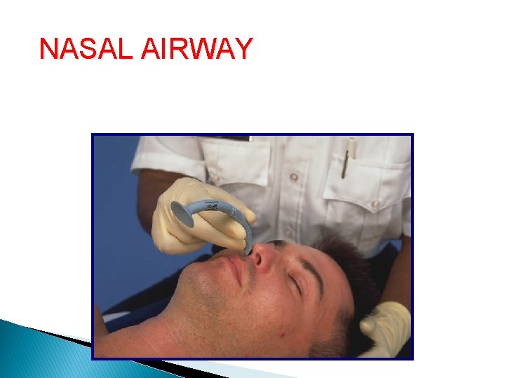 NASAL AIRWAY Nasopharyngeal Airway (cont. ) NASAL AIRWAY Nasopharyngeal Airway (cont. )