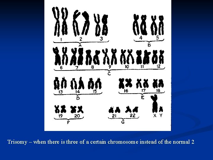 Trisomy – when there is three of a certain chromosome instead of the normal Trisomy – when there is three of a certain chromosome instead of the normal