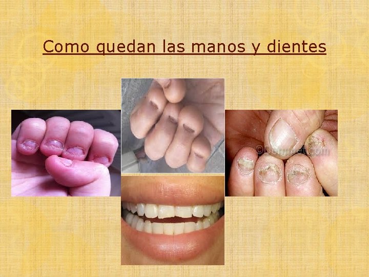 Como quedan las manos y dientes 