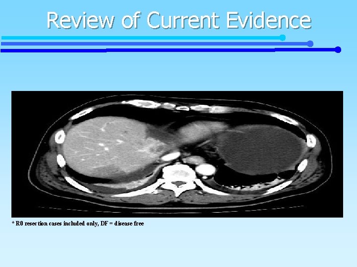 Review of Current Evidence * R 0 resection cases included only, DF = disease