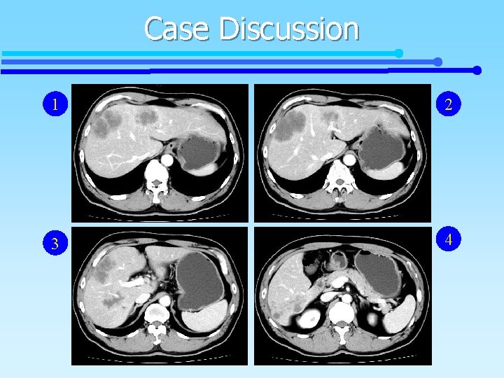 Case Discussion 1 2 3 4 