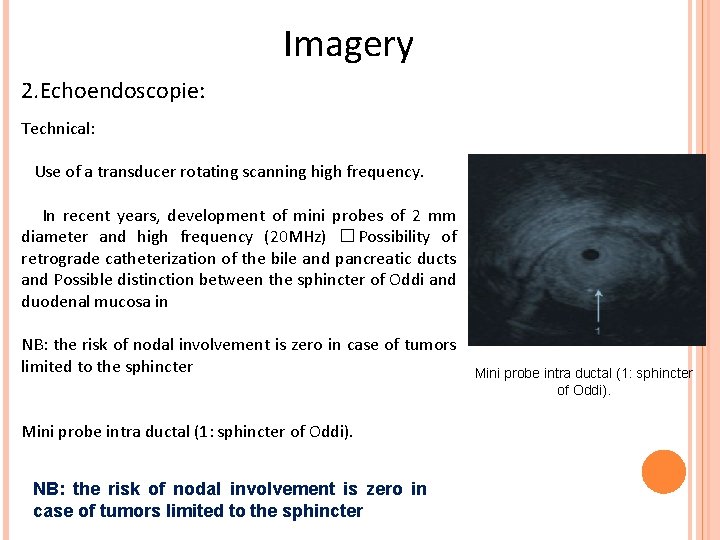 Imagery 2. Echoendoscopie: Technical: Use of a transducer rotating scanning high frequency. In recent