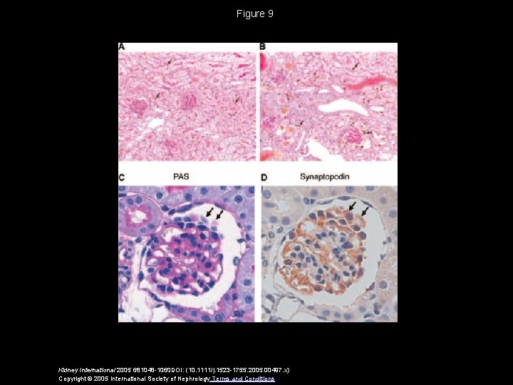 Figure 9 Kidney International 2005 681048 -1060 DOI: (10. 1111/j. 1523 -1755. 2005. 00497.