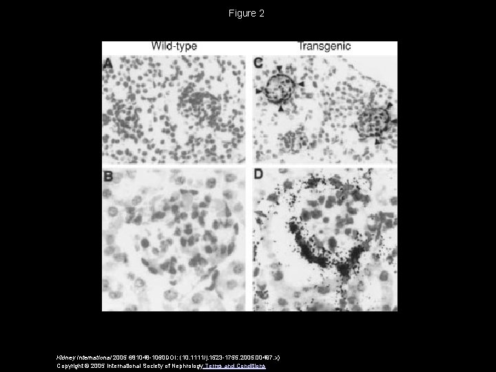 Figure 2 Kidney International 2005 681048 -1060 DOI: (10. 1111/j. 1523 -1755. 2005. 00497.