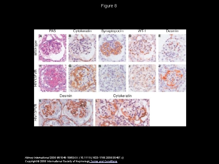 Figure 8 Kidney International 2005 681048 -1060 DOI: (10. 1111/j. 1523 -1755. 2005. 00497.