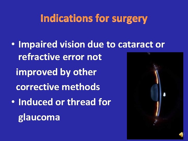 Indications for surgery • Impaired vision due to cataract or refractive error not improved