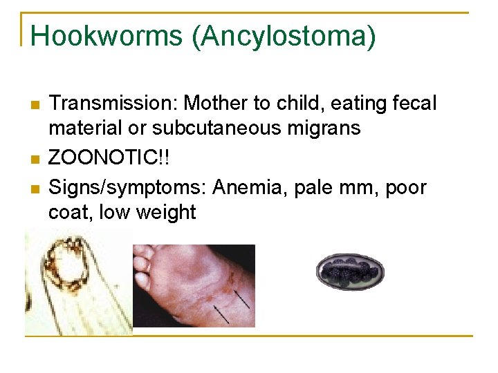 Hookworms (Ancylostoma) n n n Transmission: Mother to child, eating fecal material or subcutaneous