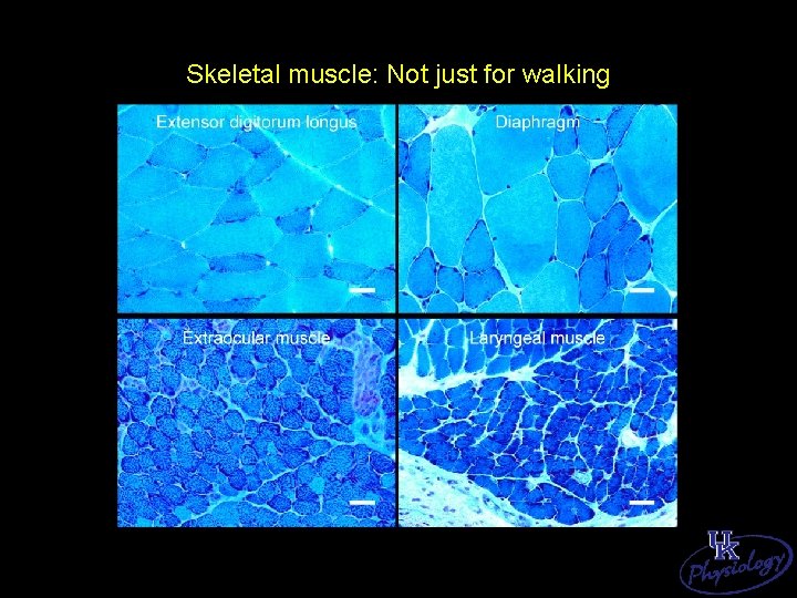 Skeletal muscle: Not just for walking 