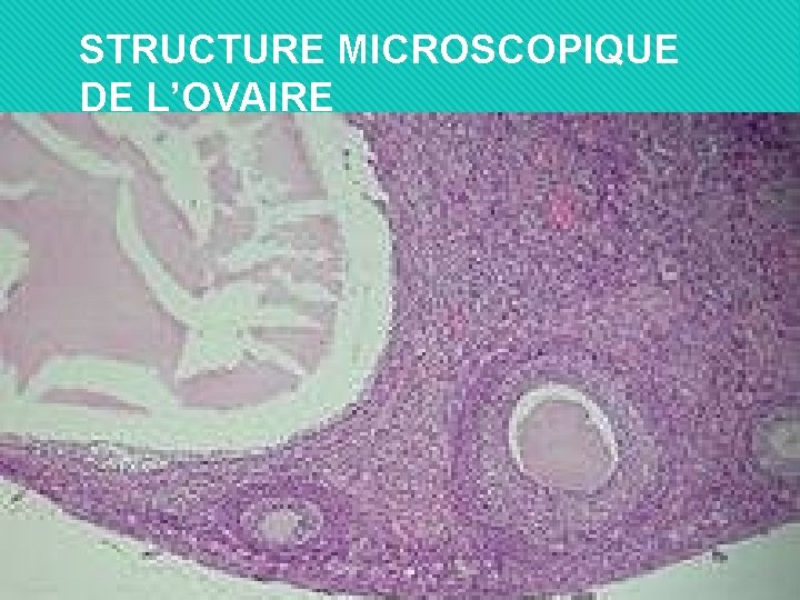 STRUCTURE MICROSCOPIQUE DE L’OVAIRE Du « charmant kyste de l’ovaire » versus le fibrome