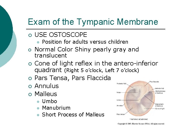 Exam of the Tympanic Membrane ¡ USE OSTOSCOPE l ¡ ¡ ¡ Position for