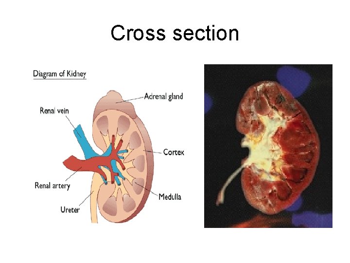 Cross section 