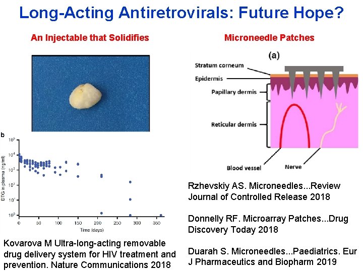 Long-Acting Antiretrovirals: Future Hope? An Injectable that Solidifies Microneedle Patches Rzhevskiy AS. Microneedles. .