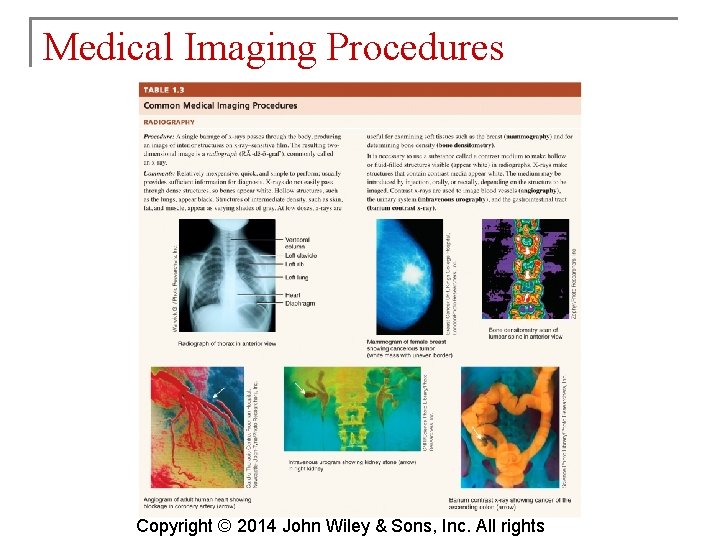 Medical Imaging Procedures Copyright © 2014 John Wiley & Sons, Inc. All rights 