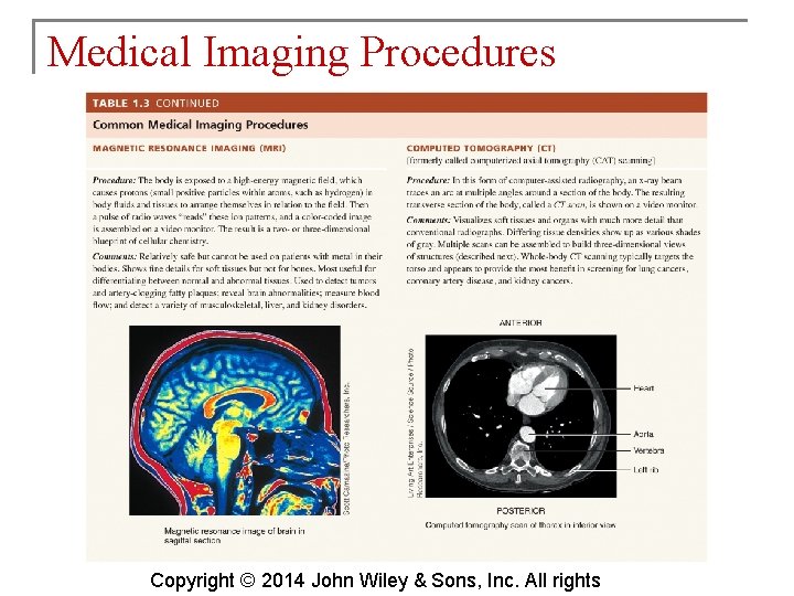 Medical Imaging Procedures Copyright © 2014 John Wiley & Sons, Inc. All rights 