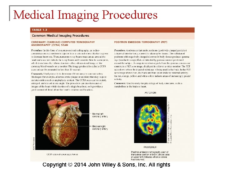 Medical Imaging Procedures Copyright © 2014 John Wiley & Sons, Inc. All rights 