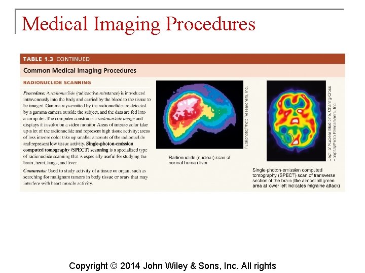 Medical Imaging Procedures Copyright © 2014 John Wiley & Sons, Inc. All rights 